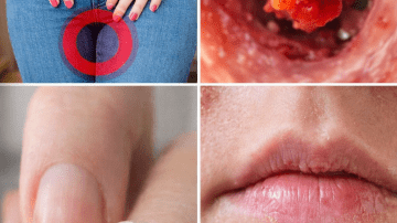 Discover 8 Unusual Signs That Might Indicate Your Body Needs More Vitamin B12