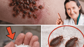 How Can Incorporating Everyday Foods into Your Diet Support Healthy Knee Joints and Cartilage with Age?