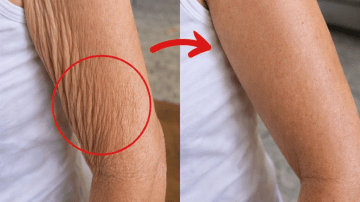 Understanding Atorvastatin Side Effects: What You Need to Know for Informed Use