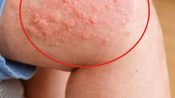 🤫 The $2 Secret Nobody Will Ever Tell You: Why Mixing Cloves and Vaseline is Your Ultimate Wellness Hack