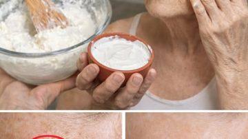 Exploring the 12 Overlooked Symptoms of Ovarian Cancer Every Woman Over 40 Needs to Know