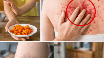 What You Should Know About Finding a Lump on Your Neck, Back, or Behind Your Ear and Next Steps