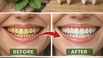 Does Baking Soda Really Help Get Rid of Fleas? Natural Home Tips to Explore