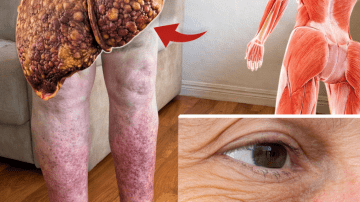 Discover the Top 3 Vitamins That May Help Support Better Circulation and Vitality for People with Diabetes