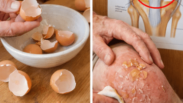 👑 The 30-Day Density Secret: Unlock Thick, Luscious Hair with the Ultimate Aloe Vera Mask