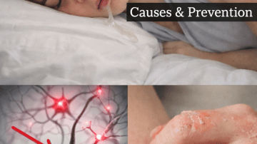 🌼 The Skin Whisperer: Euphorbia Hirta Revealed as Nature’s Ultimate Remedy for Acne, Eczema, and Irritation