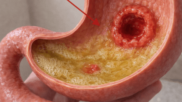 Exploring Natural Home Strategies to Help Manage Bedbug Issues in Your Garden and Living Spaces