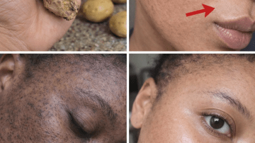 5 Powerful Daily Habits to Naturally Support Your Kidney Health After 50