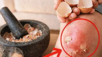 7 Natural Herbal Teas That Could Support Prostate Comfort in Men Over 40