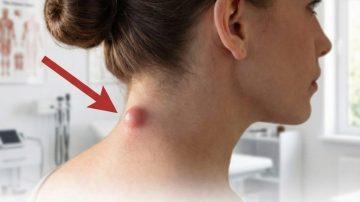 Discover the 9 Subtle Warning Signs Your Body May Show One Month Before a Heart Attack