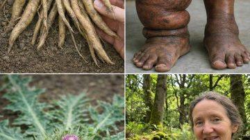 5 Powerful Daily Habits to Naturally Support Your Kidney Health After 50