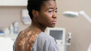 Are You Throwing Away the Most Powerful Part of Papaya Without Realizing It?